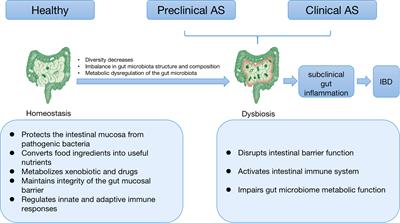 Role of the microbiome and its metabolites in ankylosing spondylitis